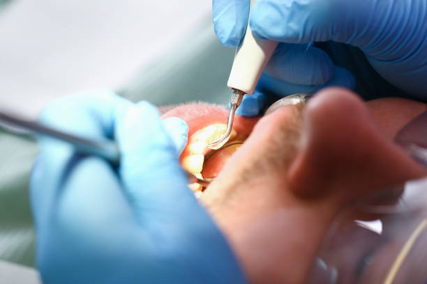 Best Emergency Dental Surgery in Gillett, WI